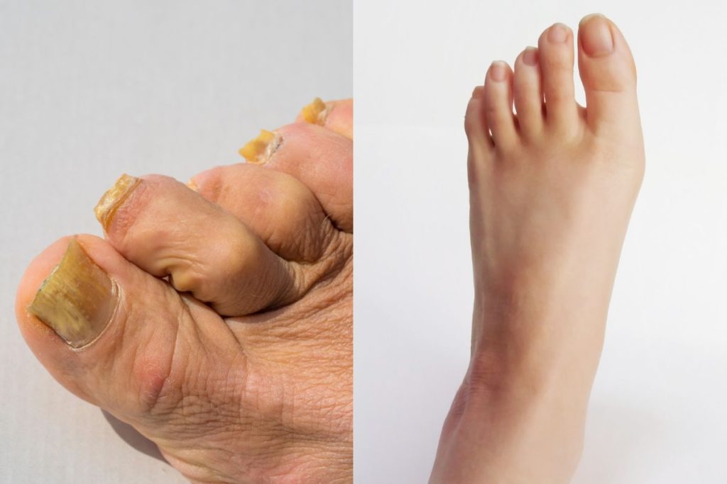 Kodėl tradiciniai lakai ir tepalai dažnai nuvilia?