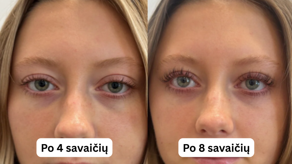 Rezultatai po 8 savaičių kasdienio naudojimo
