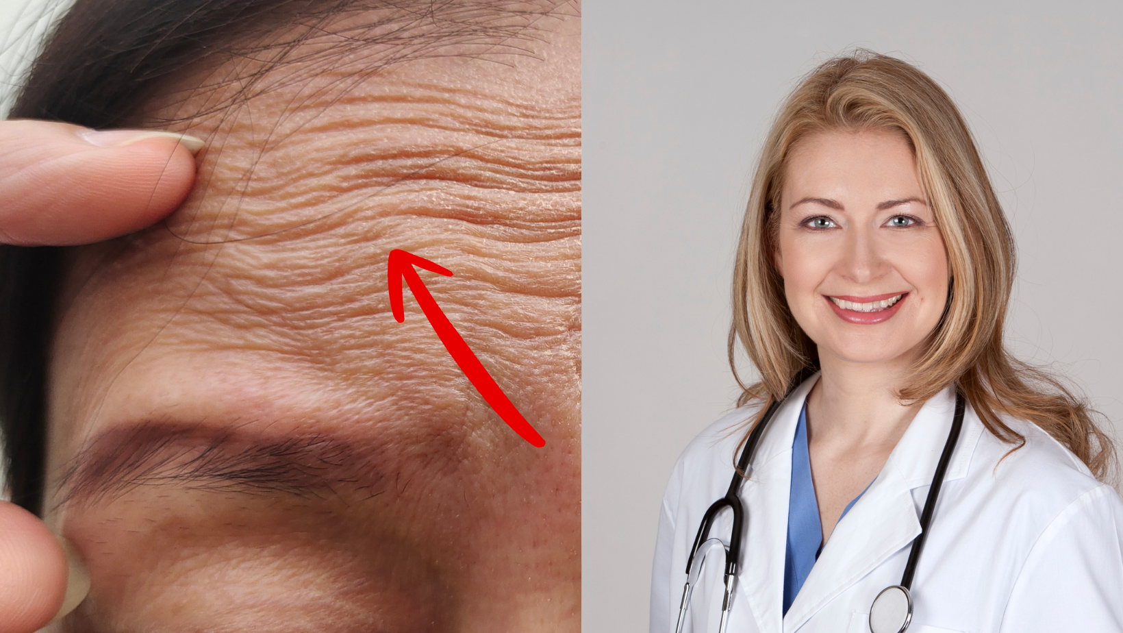 Kodėl lietuvių oda praranda stangrumą greičiau nei kitų europiečių? Gydytoja bedė pirštu į skaudžią tiesą